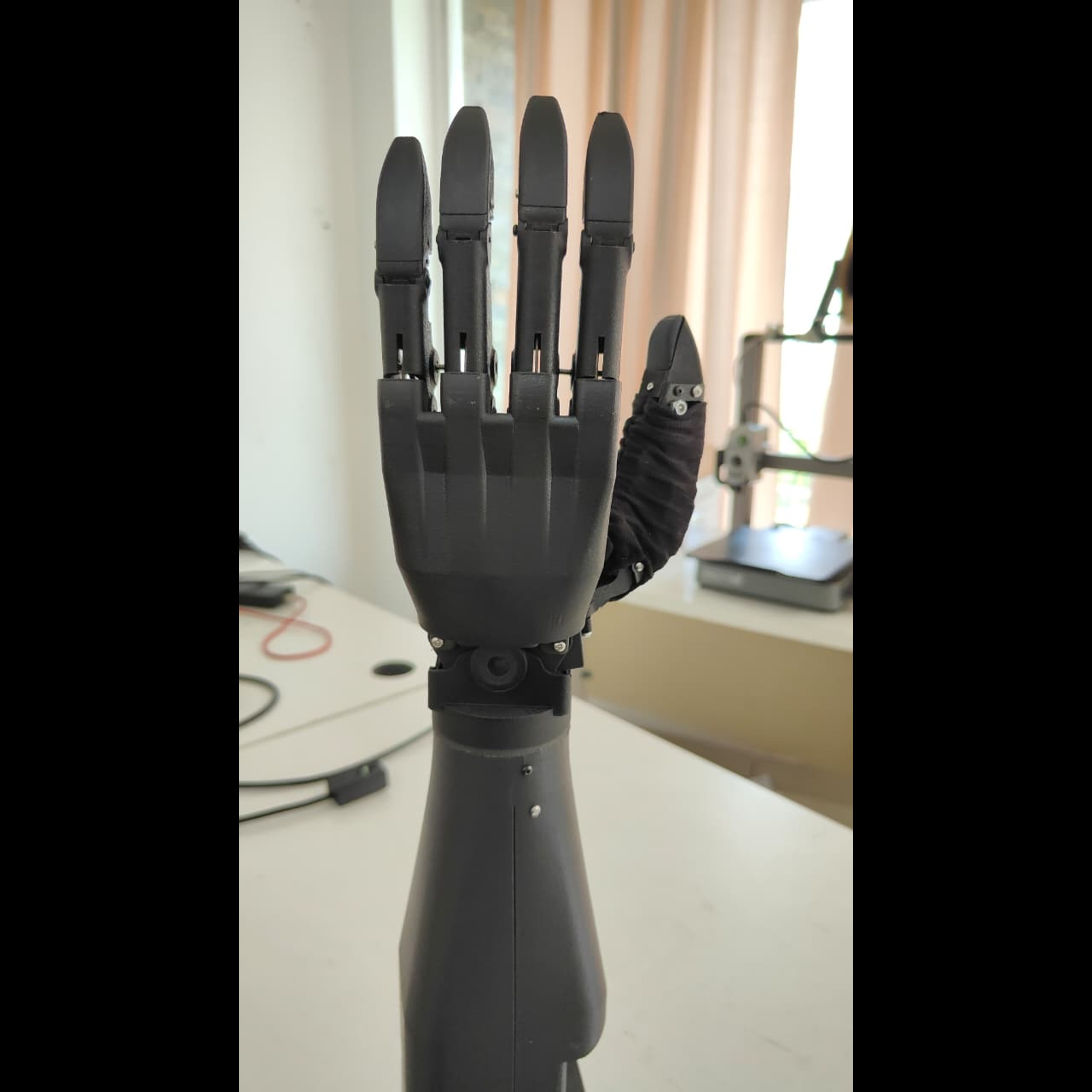 Advanced Bionic Hands in India: Technology, Benefits & Guide (2026 ...