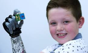 Bendita Bionics Blog Image